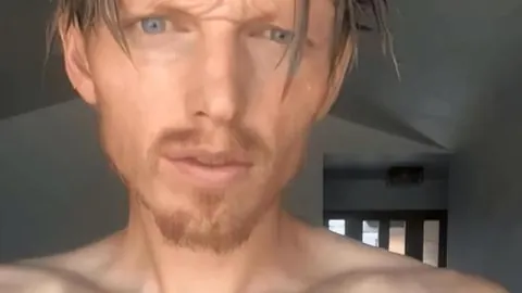 诺伊尔点球双响+扑救，科曼受伤离场，拜仁险胜奥格斯堡3-2